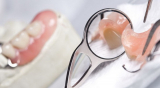 Временное шинирование зубов с применением фотополимера (один зуб)
